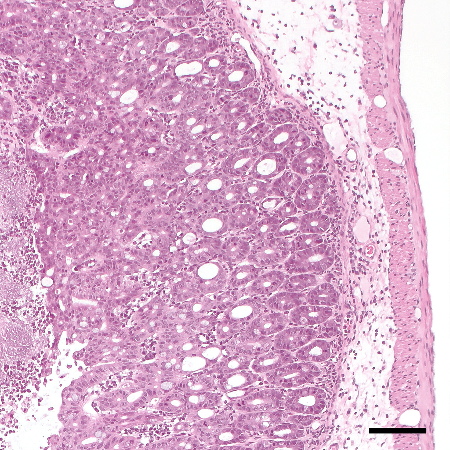 Histological staining of murine tissue infected with Yersinia pseudotuberculosis