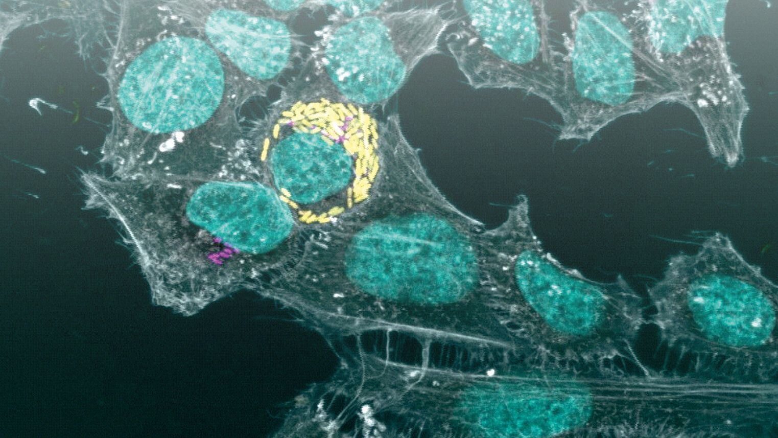 Tissue culture 