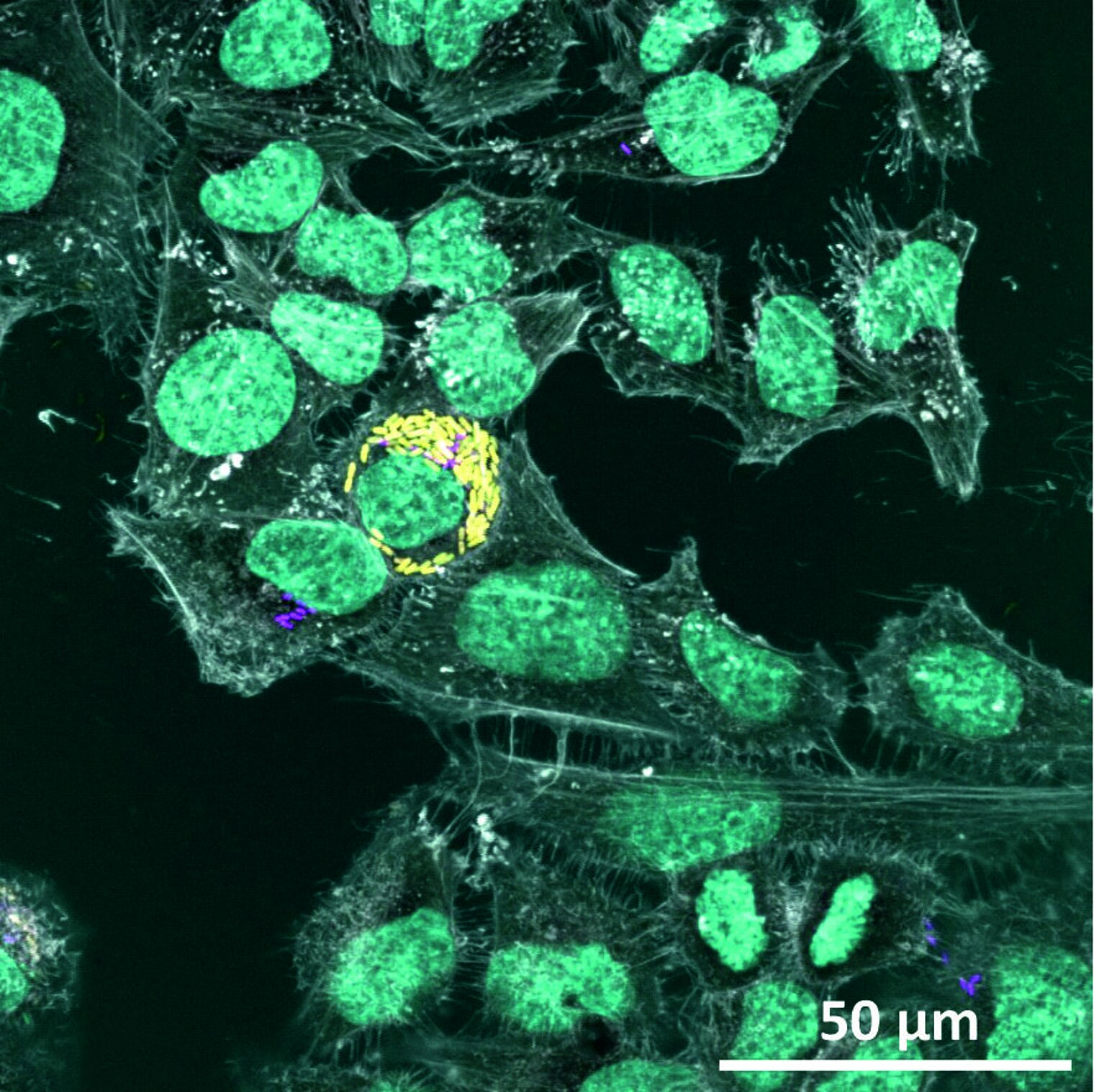 microscopic image of a salmonella infection in epithelial cells