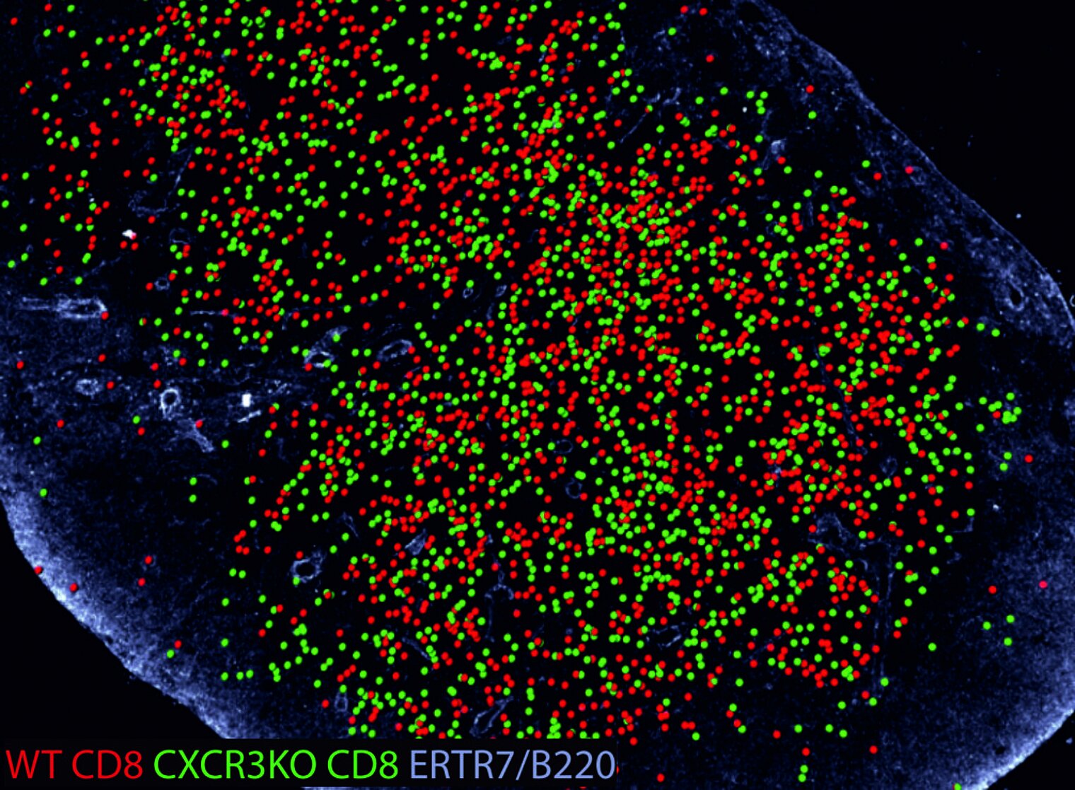 Fluorescence microscopy of a lymph node with T cells stained in red and green