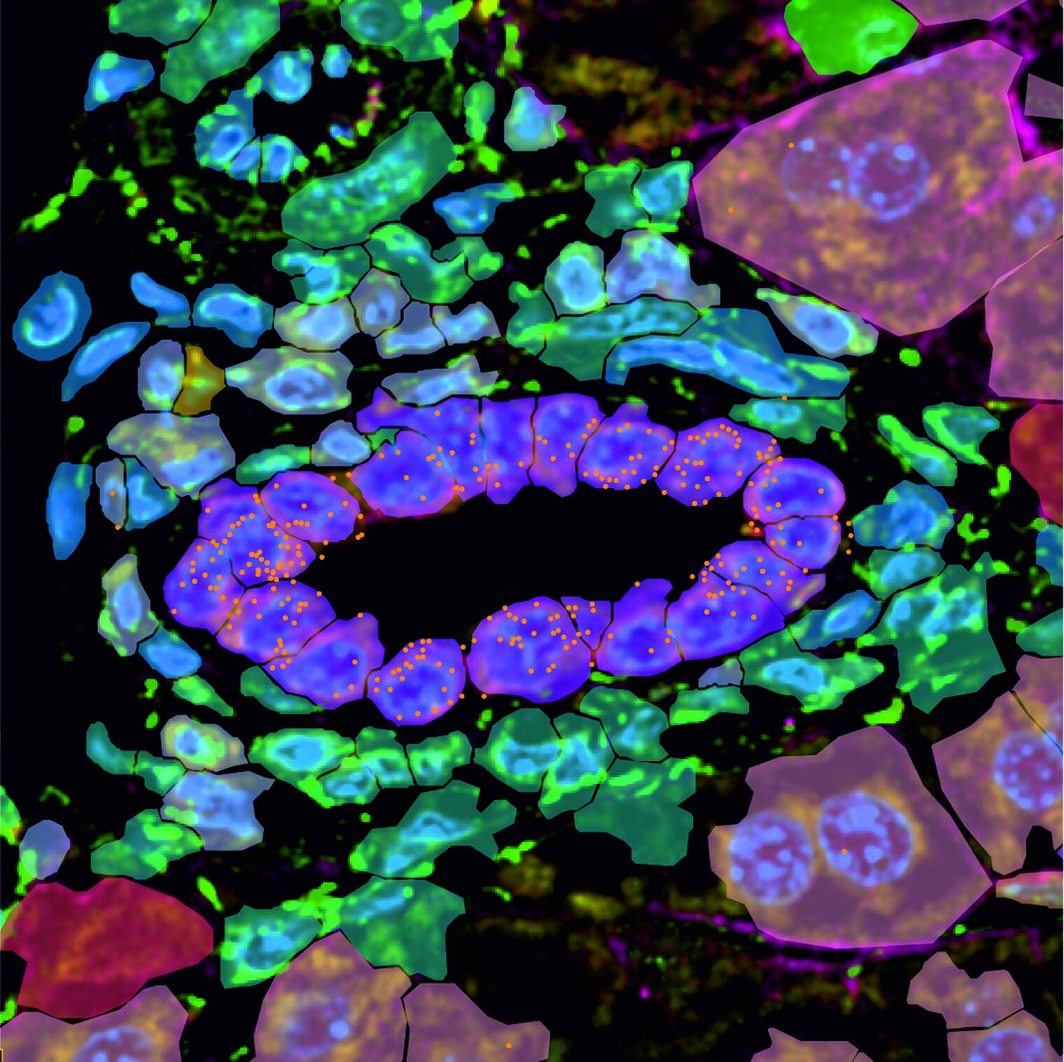Microscopic image from the analysis of transcript expression in the liver using Xenium 