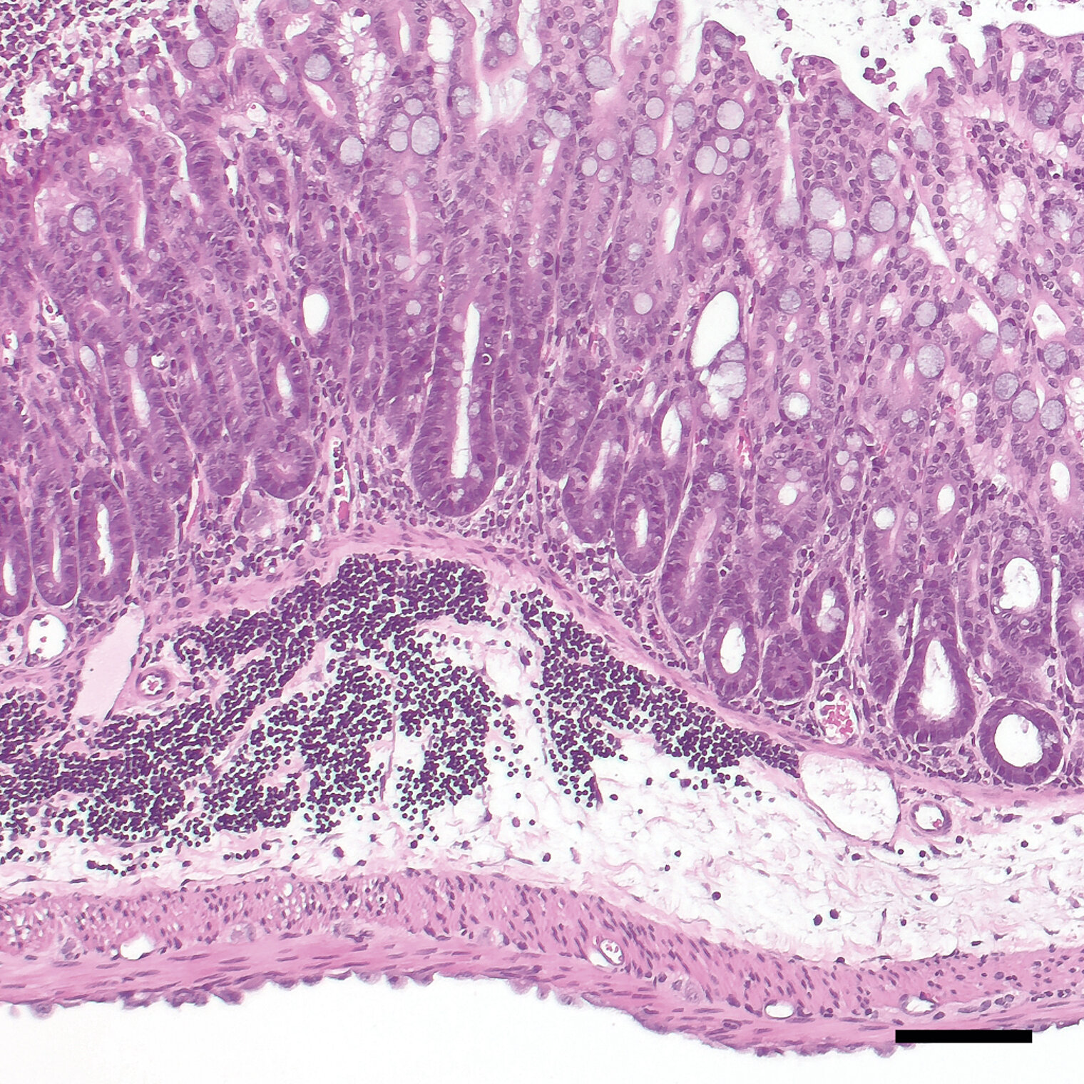 Histological staining of murine tissue infected with Yersinia pseudotuberculosis