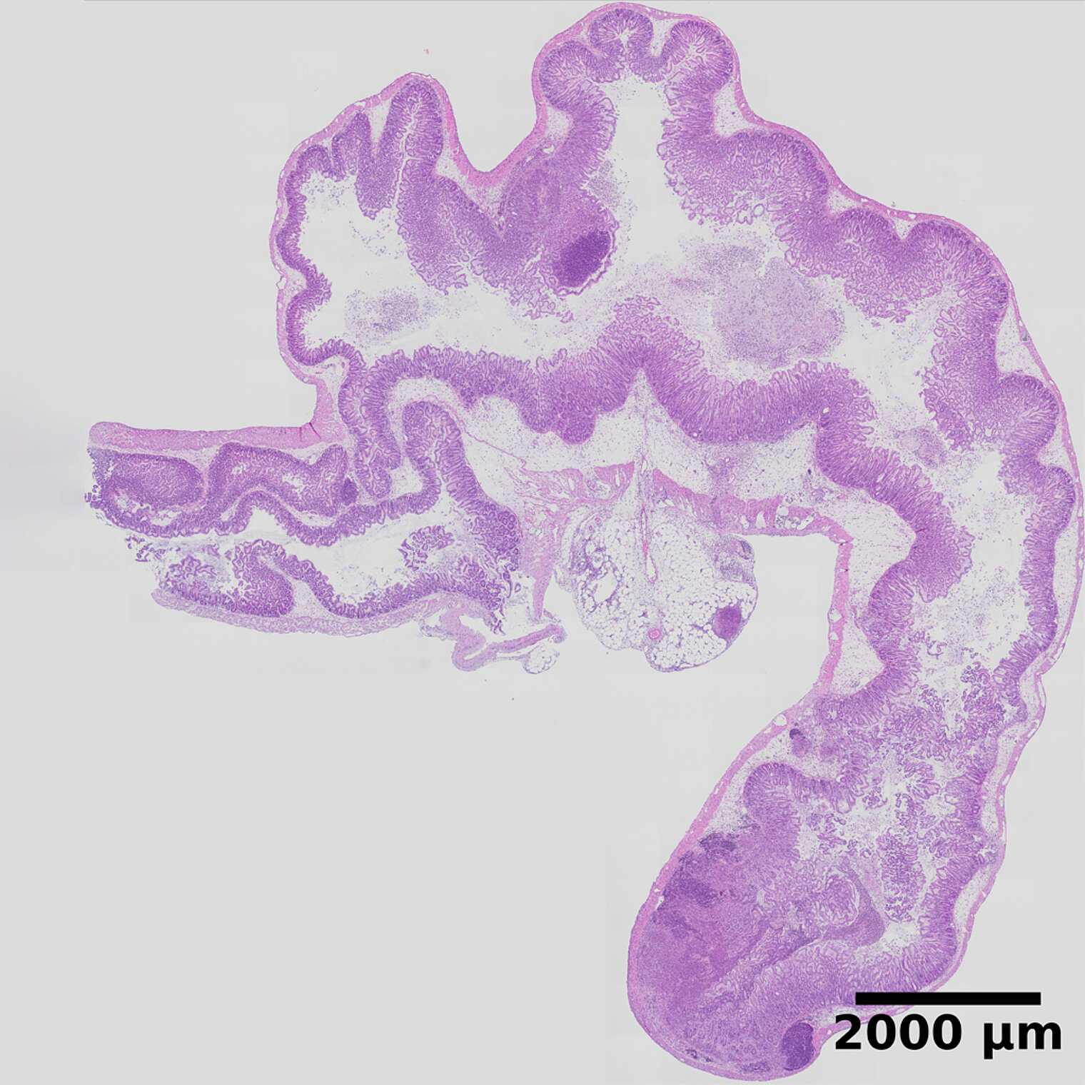 Histological staining of murine tissue infected with Yersinia pseudotuberculosis