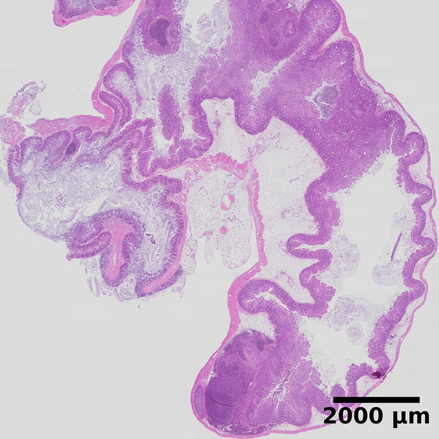 Histological staining of murine tissue infected with Yersinia pseudotuberculosis