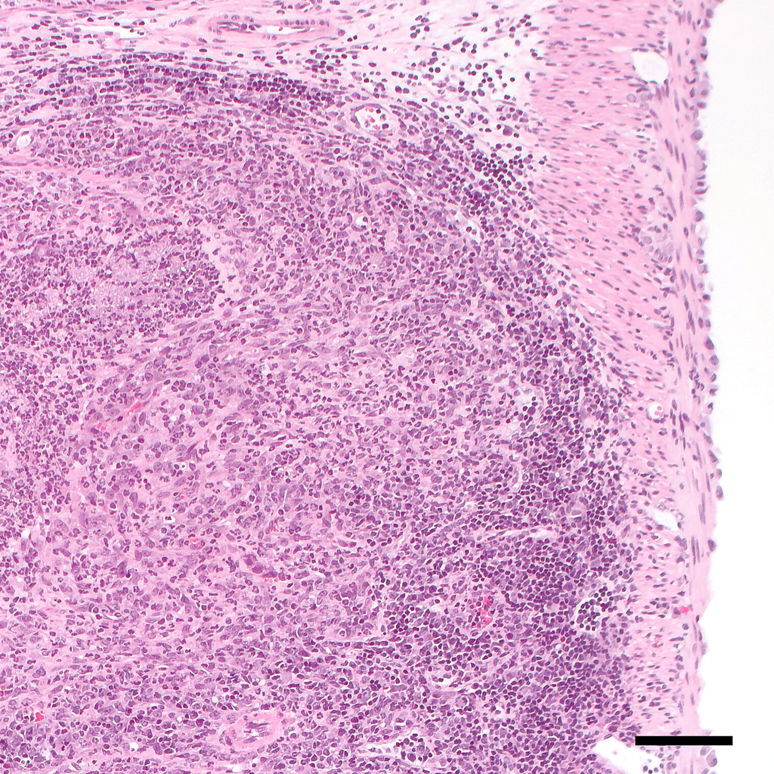 Histological staining of murine tissue infected with Yersinia pseudotuberculosis