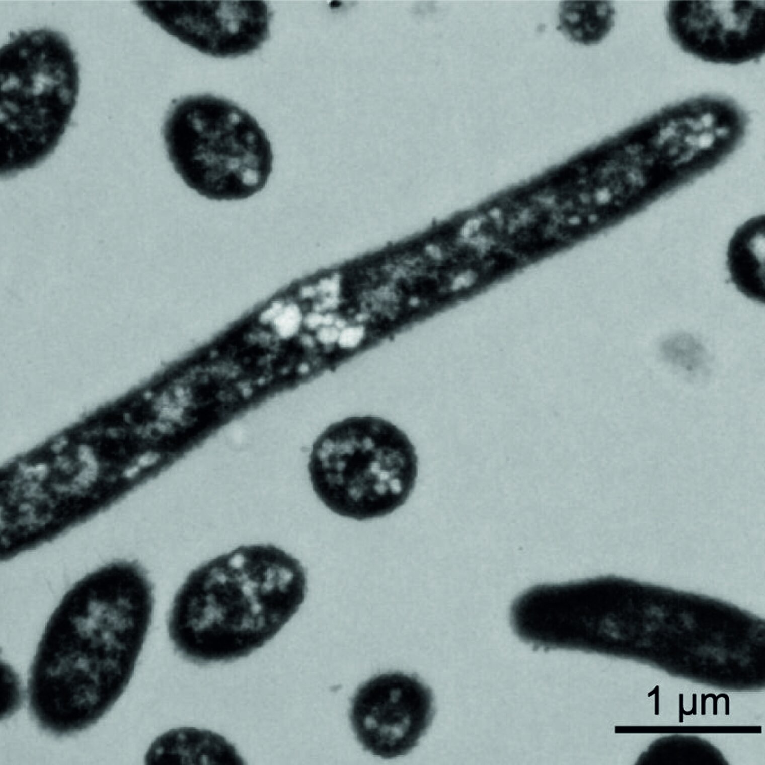 transmission electron microscopy image of Bacteroides thetaiotaomicron