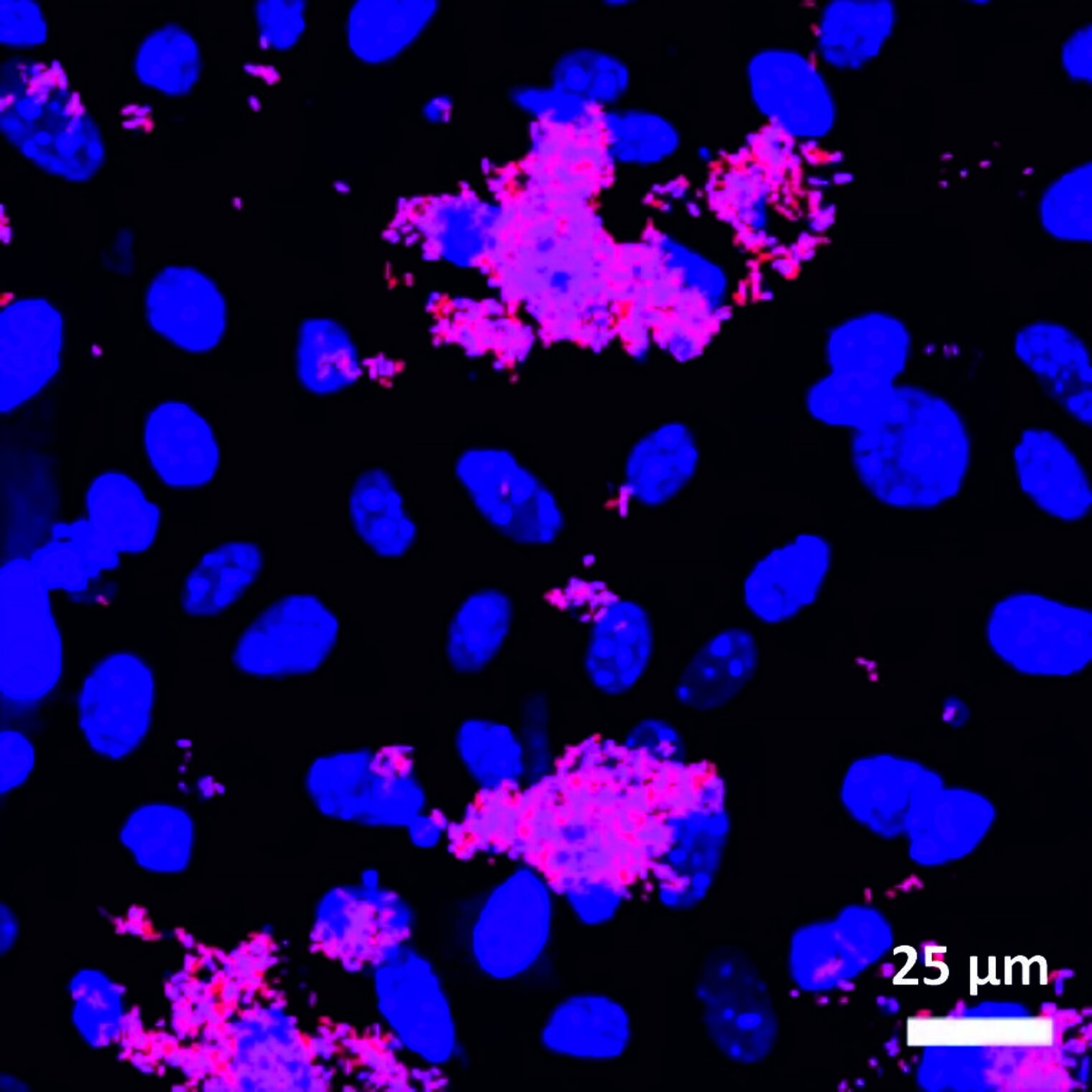 microscopic image of a 2D prostate organoid-based model infected with UPEC