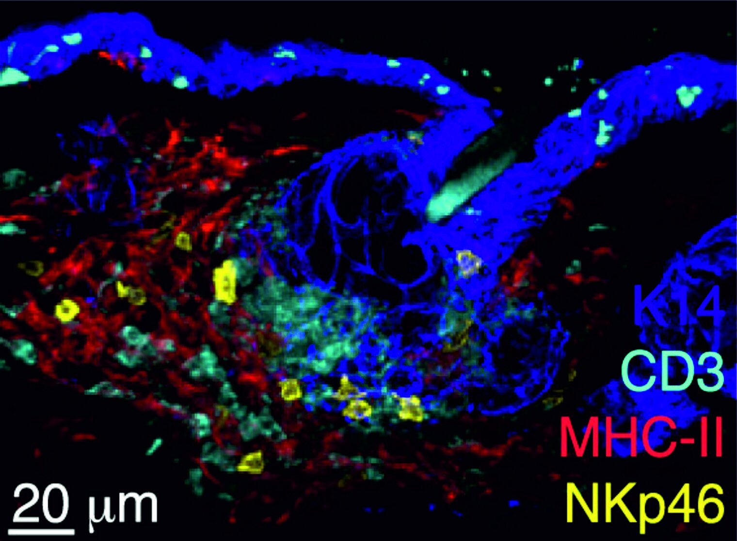 Fluorescence microscopy image of different layers of the skin stained in different colors