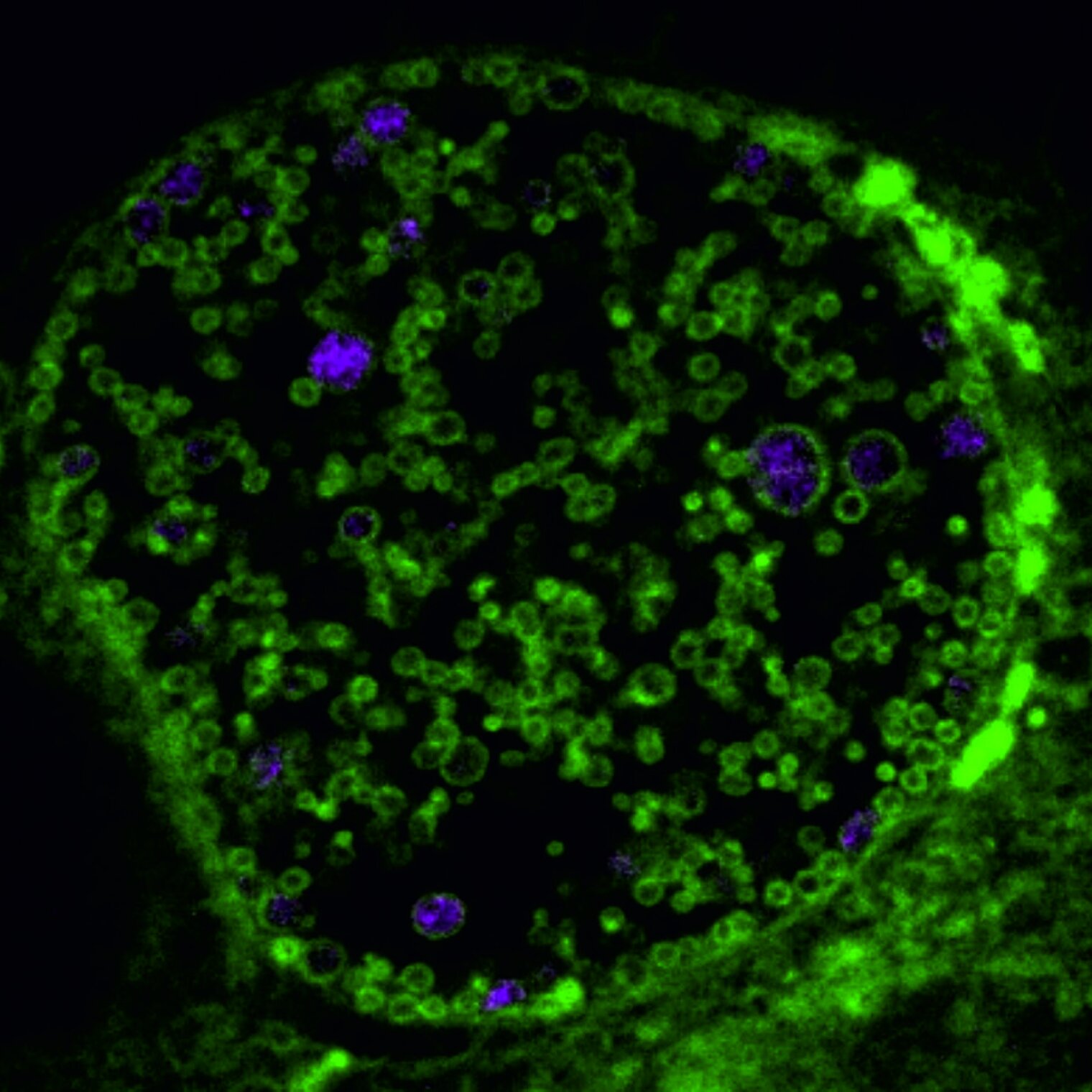 microscopic image of Chlamydia trachomatis obtained by expansion microscopy 