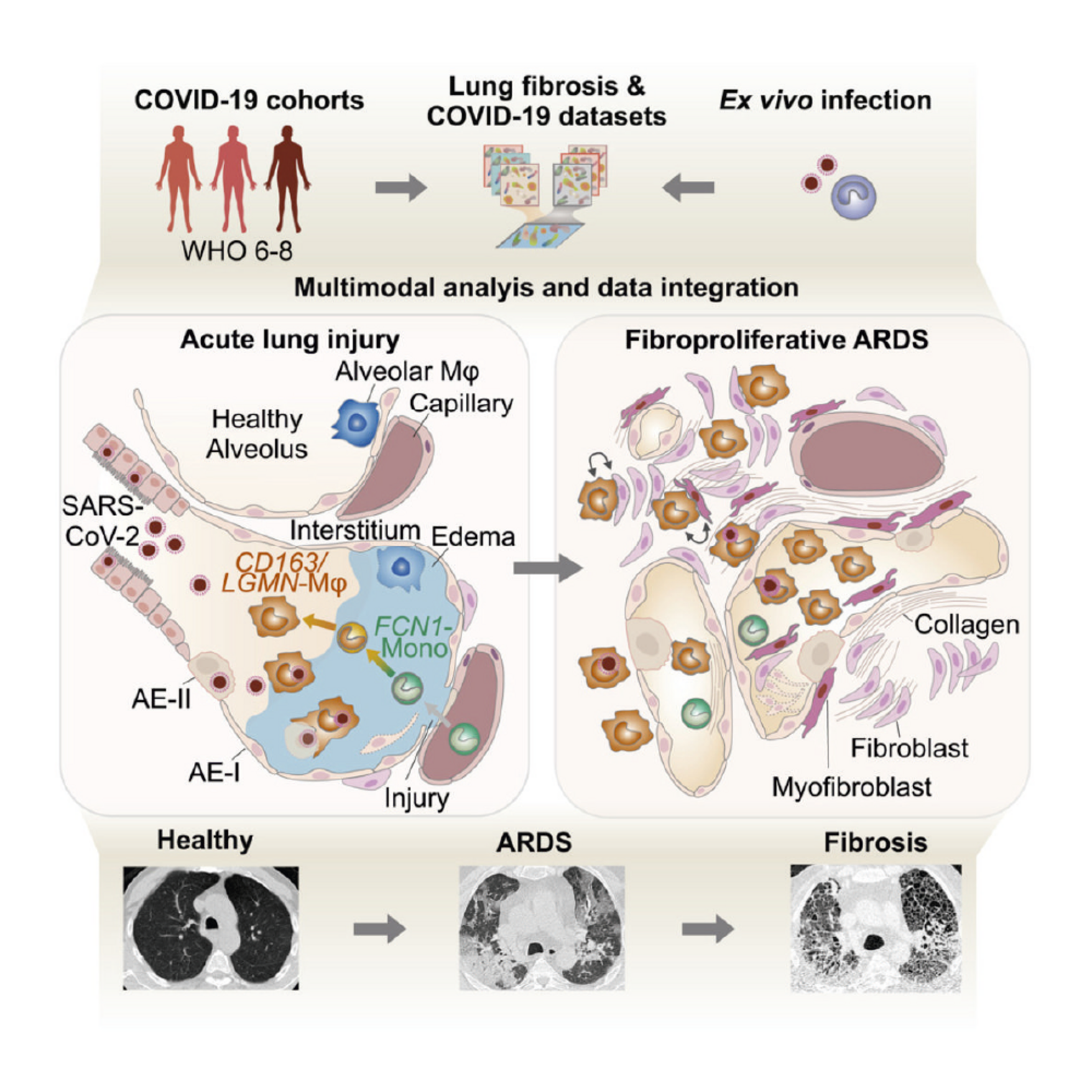 Lung remodeling in Severe COVID-19 patients