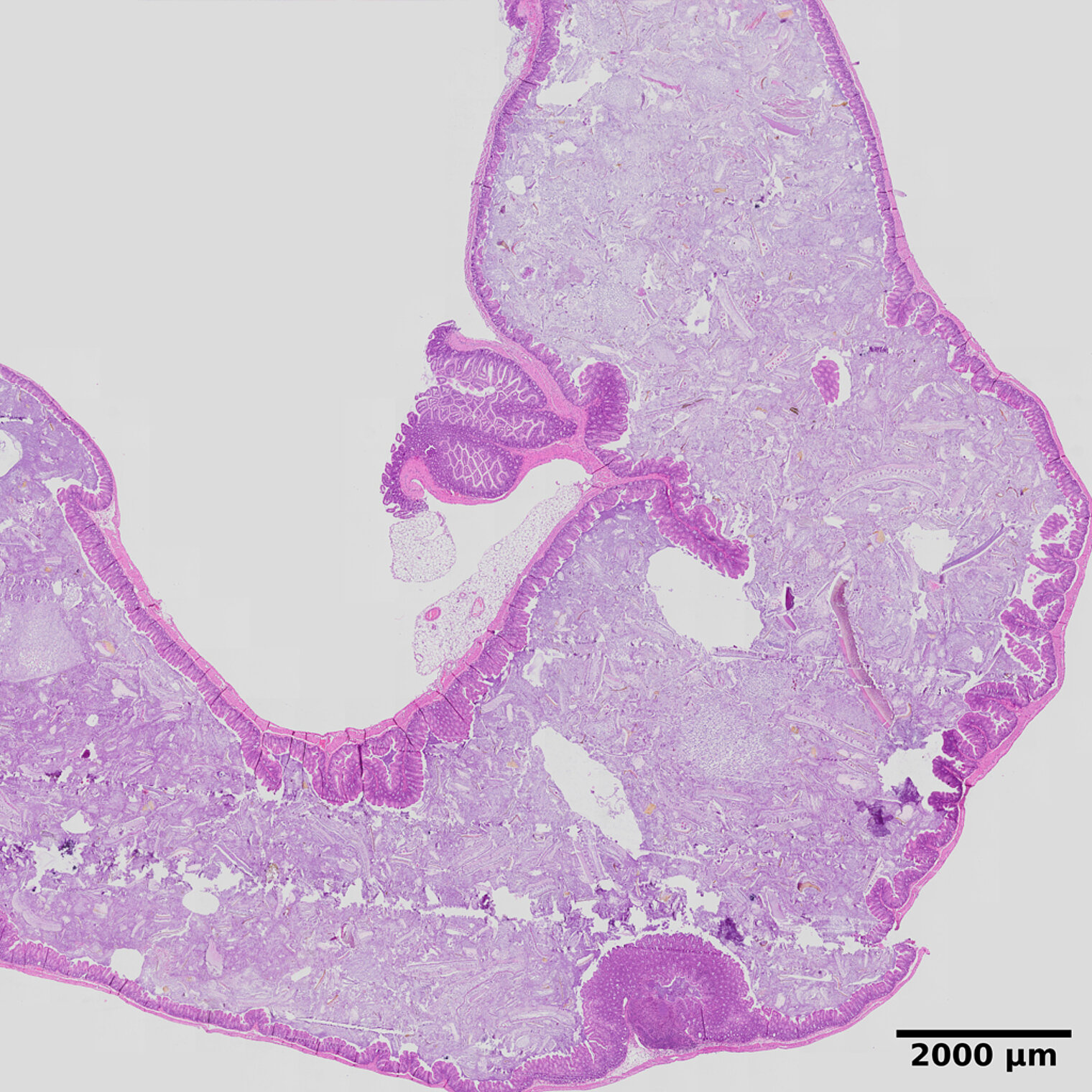 Histological staining of murine tissue infected with Yersinia pseudotuberculosis